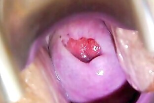 Spiky-looking housewife getting a gyno