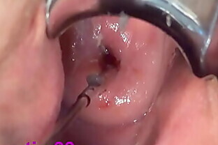 Cervix Fucking Play Deep Japanese Asian - å­å®®é ¸éƒ¨ã‚¯ã‚½