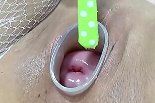 Mature wife fucking cervix and penetration in uterus with knifes